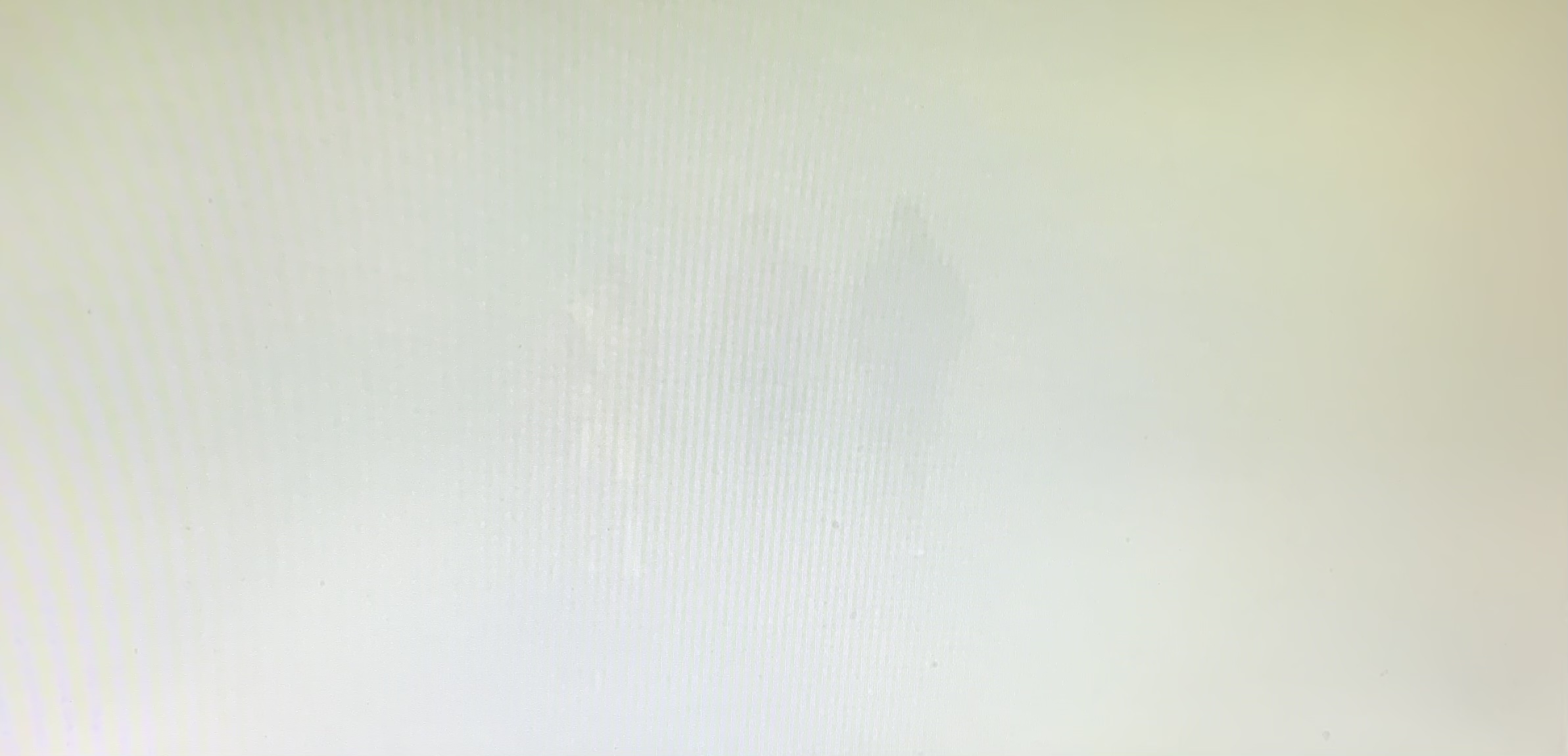 Pergolettese vs Pro Vercelli, nebbia